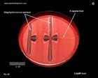 CAMP test for identification of streptococcus agalactiae (GBA)